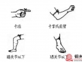 北流一名老人被眼镜蛇咬伤，所幸送医及时……